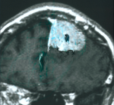 neuroimaging
